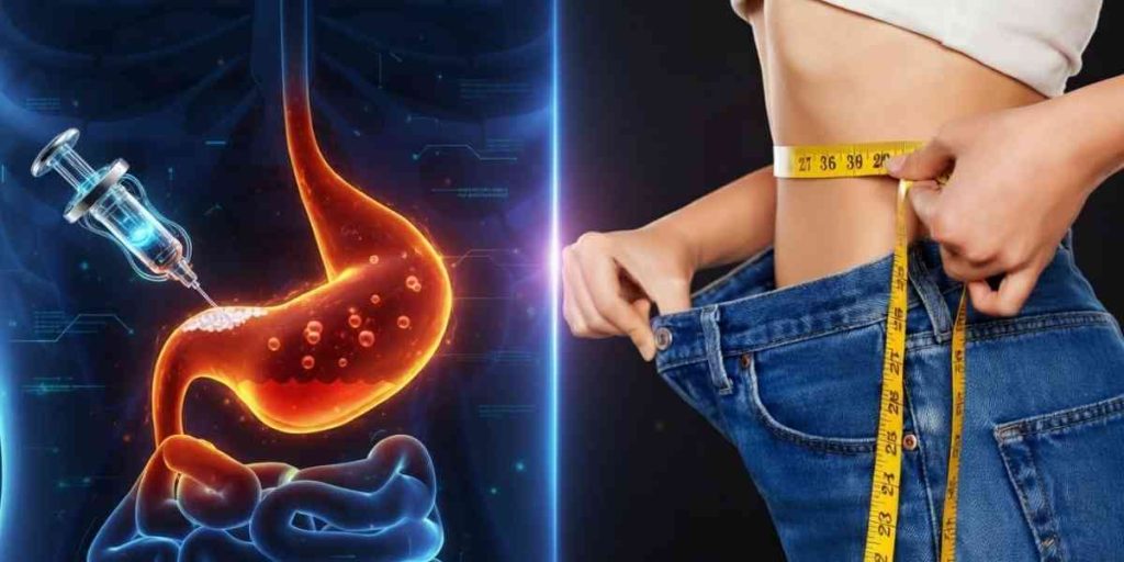 Endoscopic Gastric Botox Training